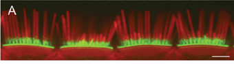 Hair cells in the ear